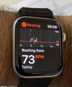Apple-Watch-1